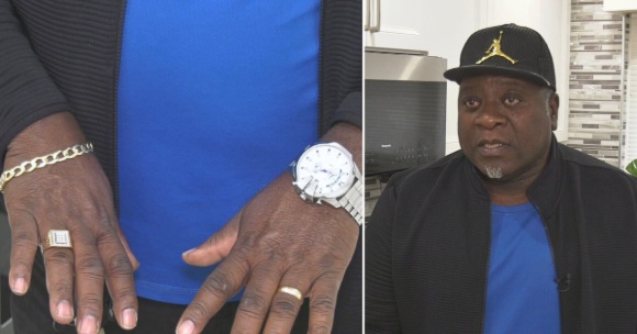 Житель Онтарио потерял вещи стоимостью $10 000 после того, как авиакомпания заставила его сдать ручную кладь